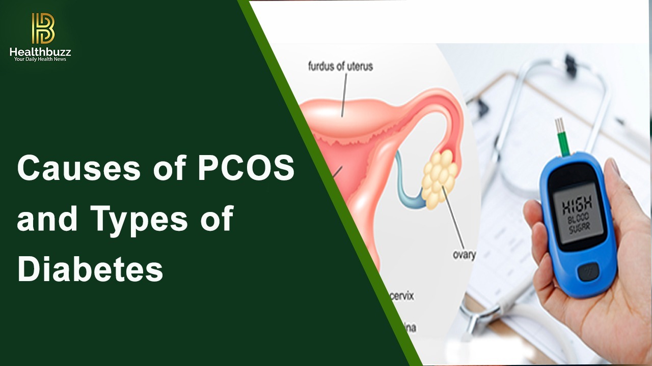 Causes of PCOS and Types of Diabetes
